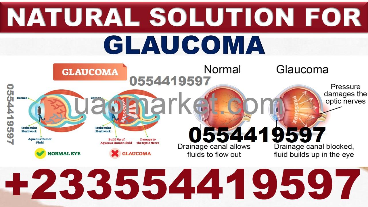 NATURAL TREATMENT FOR EYE PROBLEM| CATARACT, GLAUCOMA ETC.
