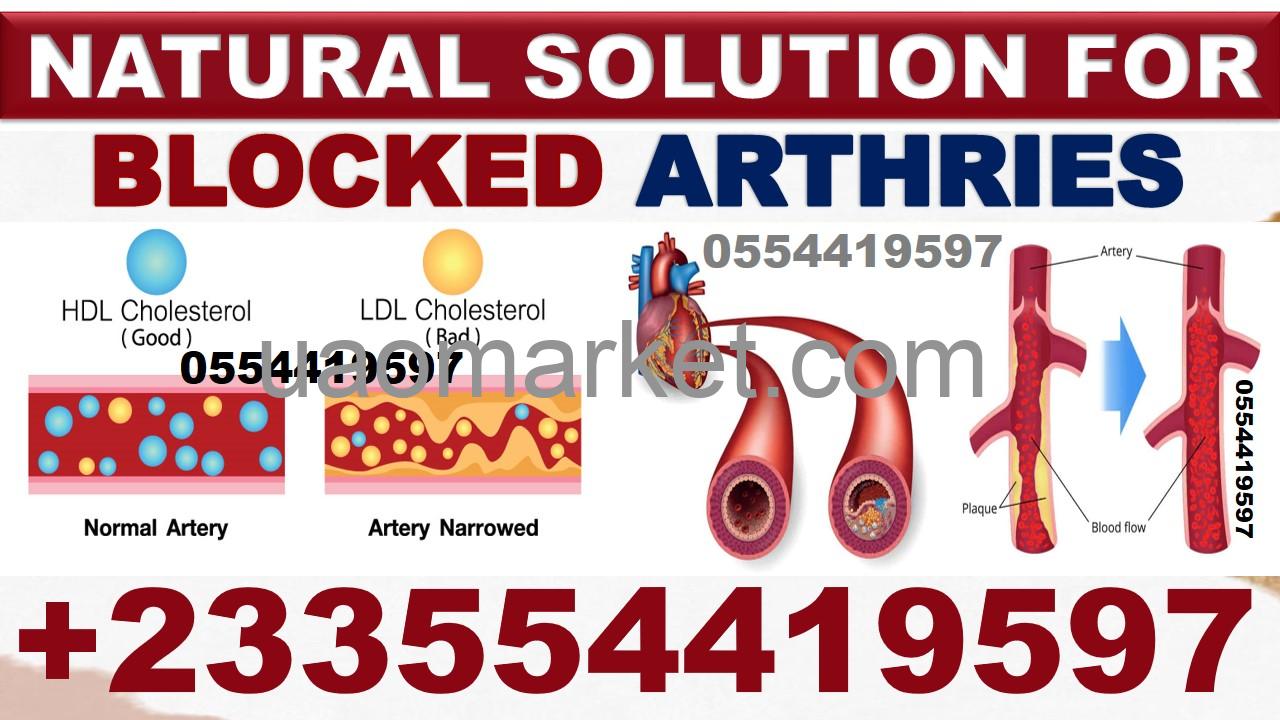 NATURAL SOLUTION FOR HIGH CHOLESTEROL