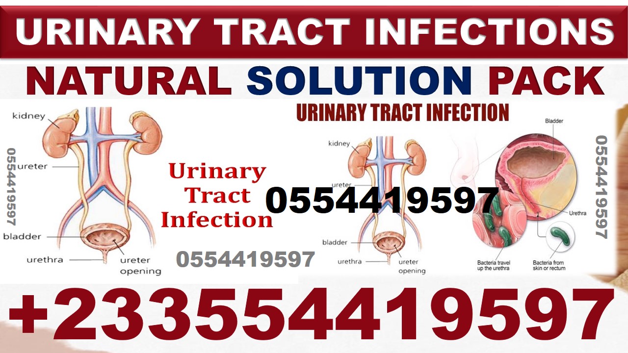 HOW TO GET RID OF EYE INFECTIO